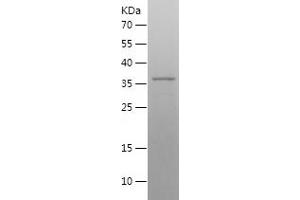 Western Blotting (WB) image for Necdin-Like 2 (NDNL2) (AA 1-304) protein (His tag) (ABIN7124123)