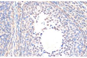 Immunohistochemistry of paraffin-embedded Rat ovary using Smad5 Polyclonal Antibody at dilution of 1:200 (40x lens). (SMAD5 Antikörper)