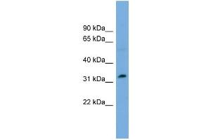 WB Suggested Anti-PHF13 Antibody Titration:  0. (PHF13 Antikörper  (Middle Region))