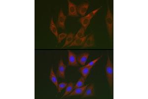 Immunofluorescence analysis of NIH/3T3 cells using Lumican (LUM) Rabbit pAb (ABIN6128190, ABIN6143388, ABIN6143389 and ABIN6220988) at dilution of 1:100 (40x lens). (LUM Antikörper  (AA 19-338))