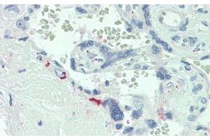 Detection of IL6R in Human Placenta Tissue using Polyclonal Antibody to Interleukin 6 Receptor (IL6R) (IL-6 Receptor Antikörper  (AA 205-347))