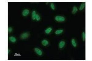 Immunostaining analysis in HeLa cells. (NAA38 Antikörper)