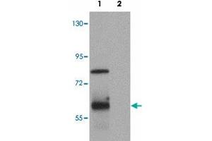 Western blot analysis of TSN in rat lung tissue lysate with TSN polyclonal antibody  at (1) 0. (Translin Antikörper  (C-Term))