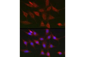 Immunofluorescence analysis of NIH/3T3 cells using RIPK1/RIP Rabbit pAb (ABIN6132596, ABIN6146959, ABIN6146960 and ABIN6223282) at dilution of 1:150 (40x lens). (RIPK1 Antikörper  (AA 170-440))