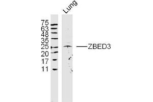 Rat lung lysates probed with ZBED3 Polyclonal Antibody, Unconjugated  at 1:300 dilution and 4˚C overnight incubation. (ZBED3 Antikörper  (AA 51-150))