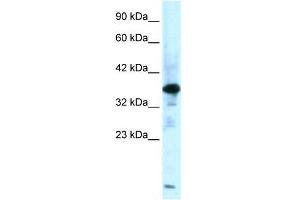 Human Muscle; WB Suggested Anti-ZFPL1 Antibody Titration: 0. (ZFPL1 Antikörper  (Middle Region))