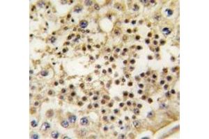 IHC analysis of FFPE human testis tissue stained with LIN28A antibody (LIN28A Antikörper)