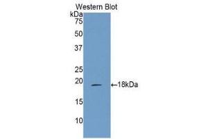 Western Blotting (WB) image for anti-Arachidonate 15-Lipoxygenase (ALOX15) (AA 170-312) antibody (ABIN3207590)