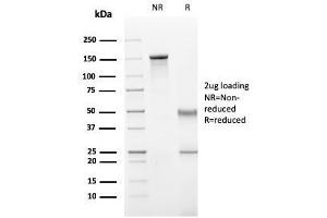 SDS-PAGE (SDS) image for anti-Integrin alpha M (ITGAM) (AA 941-1074) antibody (ABIN6939810)