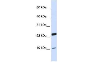 TAF13 antibody used at 0. (TAF13 Antikörper  (N-Term))