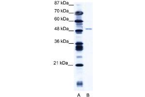 WB Suggested Anti-ZNF627 Antibody   Titration: 1. (ZNF627 Antikörper  (N-Term))