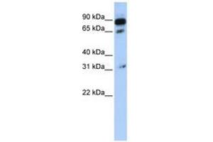 Image no. 1 for anti-ATP-Binding Cassette, Sub-Family D (Ald), Member 4 (ABCD4) (AA 108-157) antibody (ABIN6740835)