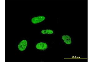 Immunofluorescence of monoclonal antibody to PRKRIP1 on HeLa cell. (PRKRIP1 Antikörper  (AA 1-184))