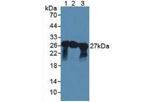 Western Blot; Sample: Lane1: Mouse Spinal Cord Tissue; Lane2: Mouse Cerebellum Tissue; Lane3: Porcine Brain Tissue.