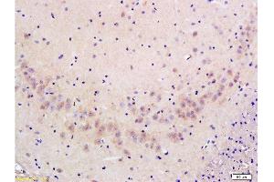 Formalin-fixed and paraffin embedded: rat brain tissue labeled with Anti-FLIP/c FLIP Polyclonal Antibody , Unconjugated at 1:300 followed by conjugation to the secondary antibody and DAB staining (FLIP Antikörper  (AA 7-100))