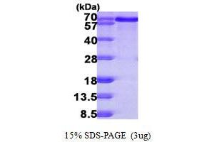 SDS-PAGE (SDS) image for B-Cell Linker (BLNK) (AA 1-456) protein (His tag) (ABIN667353) (B-Cell Linker Protein (BLNK) (AA 1-456) (His tag))