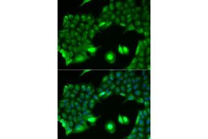 Immunofluorescence analysis of HeLa cells using SSX2 antibody.