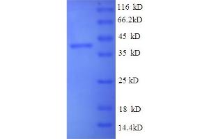 SDS-PAGE (SDS) image for Brain-Derived Neurotrophic Factor (BDNF) (AA 137-237), (partial) protein (GST tag) (ABIN5712421) (BDNF Protein (AA 137-237, partial) (GST tag))