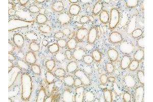 ABIN6264177 and ABIN6273064 at 1/100 staining human normal kidney tissue by IHC-P. (PHGDH Antikörper  (N-Term))