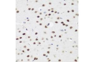 Immunohistochemistry of paraffin-embedded mouse brain using  antibody (ABIN6131366, ABIN6136608, ABIN6136609 and ABIN6223268) at dilution of 1:200 (40x lens). (AEBP2 Antikörper  (AA 234-503))