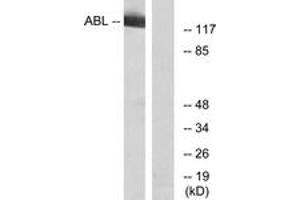Western blot analysis of extracts from RAW264. (ABL1 Antikörper  (AA 406-455))