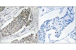 Immunohistochemistry (IHC) image for anti-Potassium Voltage-Gated Channel, Shaker-Related Subfamily, beta Member 3 (KCNAB3) (AA 293-342) antibody (ABIN1535464)