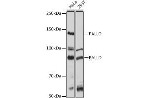 Western blot analysis of extracts of various cell lines, using PALLD antibody  at 1:1000 dilution. (PALLD Antikörper  (AA 383-672))