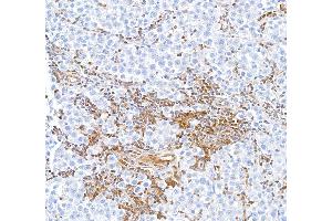 Immunohistochemistry (IHC) image for anti-Signal Transducer and Activator of Transcription 5A (STAT5A) (AA 744-794) antibody (ABIN7454017) (Rekombinanter STAT5A Antikörper  (AA 744-794))