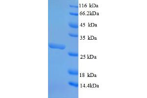 SDS-PAGE (SDS) image for Oxidized Low Density Lipoprotein (Lectin-Like) Receptor 1 (OLR1) (AA 58-273), (Extracellular) protein (His tag) (ABIN5710047) (OLR1 Protein (AA 58-273, Extracellular) (His tag))