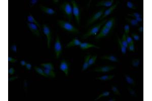 Immunofluorescence staining of Hela Cells with ABIN7127809 at 1:50, counter-stained with DAPI. (Rekombinanter SIRT1 Antikörper)