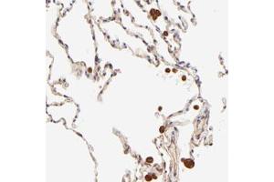 Immunohistochemical staining of human lung with TNFAIP3 polyclonal antibody  shows strong cytoplasmic positivity in macrophages. (TNFAIP3 Antikörper)