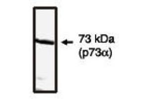 Image no. 1 for anti-Tumor Protein P73 (TP73) (C-Term) antibody (ABIN265052) (Tumor Protein p73 Antikörper  (C-Term))