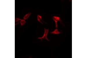 ABIN6274712 staining LOVO by IF/ICC. (AGPAT5 Antikörper  (Internal Region))