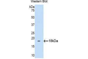 Western blot analysis of the recombinant protein. (Biglycan Antikörper  (AA 49-182))