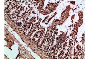Immunohistochemical analysis of paraffin-embedded human-colon, antibody was diluted at 1:200 (IL17C Antikörper  (AA 81-130))