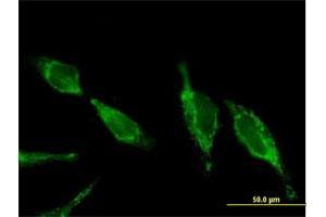 Immunofluorescence (IF) image for anti-Ubiquinol-Cytochrome C Reductase Core Protein II (UQCRC2) (AA 1-453) antibody (ABIN521272)