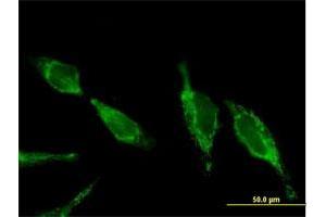 Immunofluorescence of purified MaxPab antibody to UQCRC2 on HeLa cell. (UQCRC2 Antikörper  (AA 1-453))
