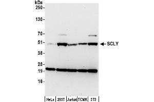 anti-Selenocysteine Lyase (SCLY) (AA 395-445) antibody