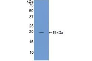 Detection of Recombinant PROCR, Rat using Polyclonal Antibody to Endothelial protein C receptor (EPCR) (PROCR Antikörper  (AA 59-217))