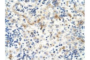 MOV10 antibody was used for immunohistochemistry at a concentration of 4-8 ug/ml to stain Hepatocytes (arrows) in Human Liver. (MOV10 Antikörper)