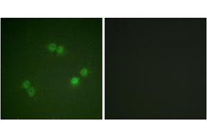 Immunofluorescence analysis of A549 cells, using SF1 (Phospho-Ser82) antibody. (Splicing Factor 1 Antikörper  (pSer82))