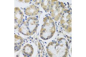 Immunohistochemistry of paraffin-embedded human stomach using MRPL1 antibody. (MRPL1 Antikörper  (AA 51-325))