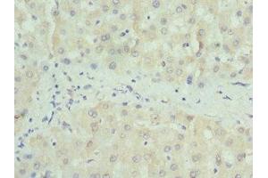 Immunohistochemistry of paraffin-embedded human liver tissue using ABIN7160326 at dilution of 1:100 (PAICS Antikörper  (AA 176-425))
