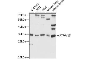 Western blot analysis of extracts of various cell lines, using V1D antibody (ABIN6127397, ABIN6137348, ABIN6137349 and ABIN6216761) at 1:3000 dilution. (ATP6V1D Antikörper  (AA 1-247))