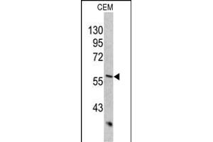 Western blot analysis of KRT10 antibody (Center) (ABIN390659 and ABIN2840954) in CEM cell line lysates (35 μg/lane). (Keratin 10 Antikörper  (AA 318-346))