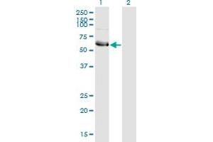 Western Blot analysis of HSFY1 expression in transfected 293T cell line by HSFY1 monoclonal antibody (M10), clone 1D2. (HSFY1 Antikörper  (AA 1-99))