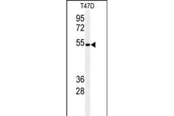 POGLUT1 Antikörper  (C-Term)
