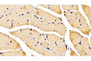Detection of NT5C in Mouse Skeletal muscle Tissue using Polyclonal Antibody to 5',3'-Nucleotidase, Cytosolic (NT5C)