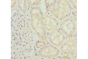 Immunohistochemistry of paraffin-embedded human kidney tissue using ABIN7156314 at dilution of 1:100 (INPP5K Antikörper  (AA 149-448))