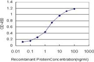 Detection limit for recombinant GST tagged STAG1 is approximately 0. (Stromal Antigen 1 Antikörper  (AA 1112-1221))